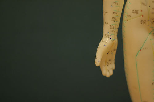 does acupuncture work?