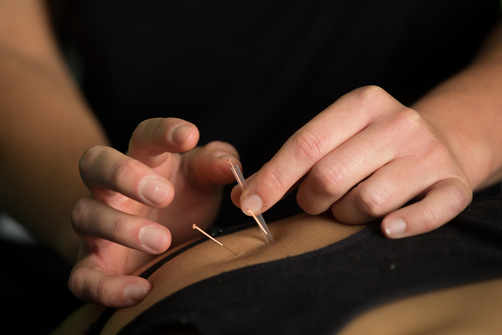 How Acupuncture is the Perfect Summertime Remedy